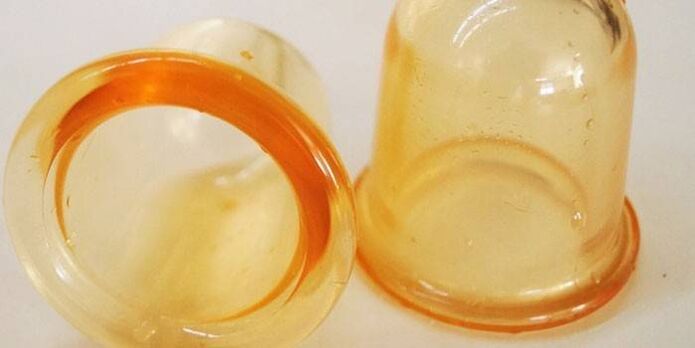 coupes pour le traitement de la prostatite